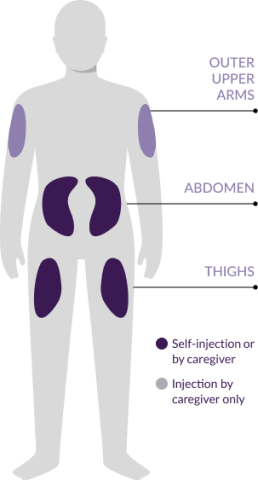 A graphic showing the outline of a person with areas highlighted on the upper arms, abdomen, and thighs showing where NEMLUVIO® may be self-injected or administered by a caregiver.