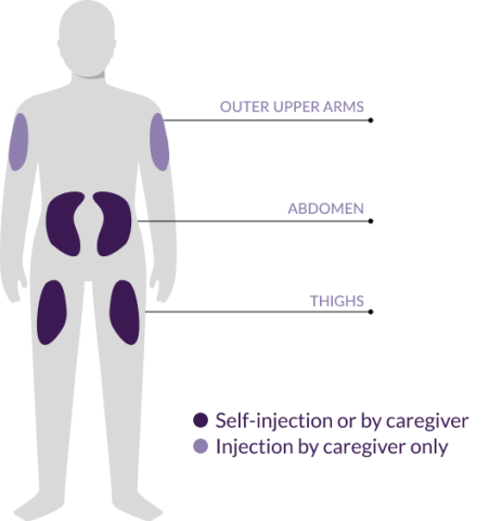 A graphic showing the outline of a person with areas highlighted on the upper arms, abdomen, and thighs showing where NEMLUVIO® may be self-injected or administered by a caregiver.